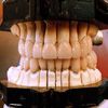 Reconstructie dentara