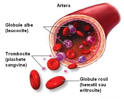 Anemia feripriva (prin carenta de fier)