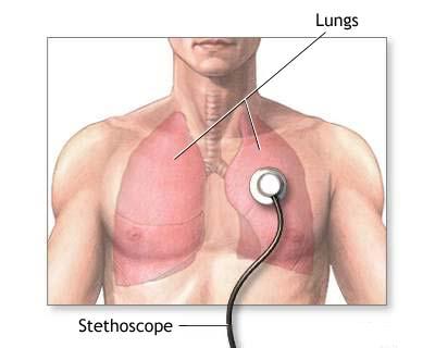 Sindromul respirator acut sever (SRAS)
