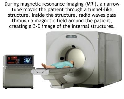 Imagistica prin rezonanta magnetica (IRM sau RMN)