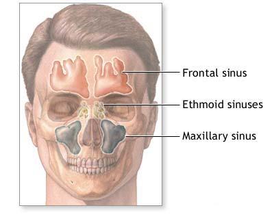 Sinuzita (Infectia sinusurilor)
