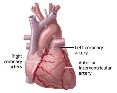 Bolile cardiovasculare