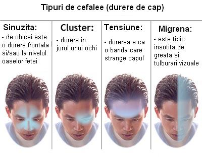 Tipuri de durere de cap