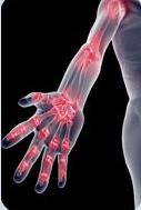 de ce artrita este tratată în cardiologie
