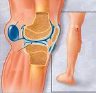 apa la genunchi tratament naturist cum simptomele durerii articulare la șold