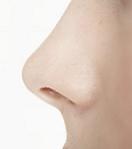 Se asociaza cu inflamatia nasului si sinusurilor