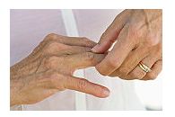 artrita seronegativă cum să tratezi