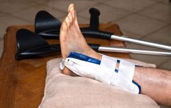 Probleme cu fractura de glezna. Cum poate face minuni recuperarea medicală pentru fracturi?