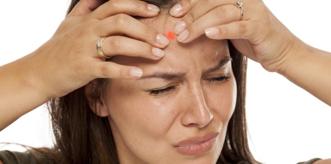 Dureri articulare și erupții acneice. Totul despre acnee: cauze, simptome, tratament