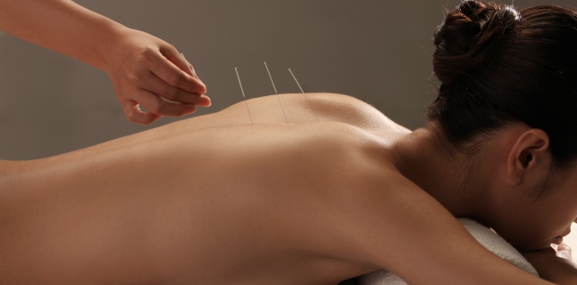 Acupunctura, o optiune viabila in tratamentul gonartrozei