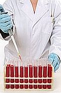 Testul de dozare a anticorpilor antinucleari