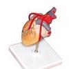 Anatomia inimii - camerele inimii si peretele cardiac