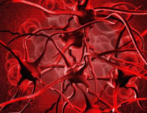 anemia cauzează boala articulară