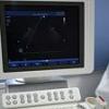 Sase femei pe zi mor in Romania din cauza cancerului de col uterin