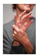 Afla totul despre artroza: Simptome, tipuri, diagnostic si tratament | gandlicitat.ro