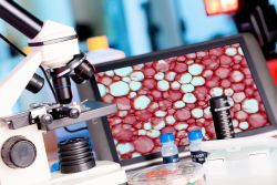 ''Biopsia lichida'', o noua metoda revolutionara de detectare a cancerului in stadii incipiente
