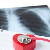 OMS atrage atentia asupra mortalitatii din cauza bolilor cardiovasculare