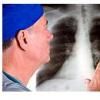 7 simptome ale bolilor pulmonare
