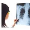 5 cauze ale aparitiei cancerului pulmonar la nefumatori