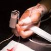 Costul medicatiei romanilor cu HIV - 50 de milioane de euro pe an