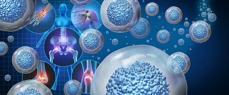 Eficienta celulelor stem in tratarea bolilor