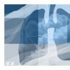 Al XXII-lea Congres al Societatii Romane de Pneumologie 'Plamanul - tinta sau cauza'