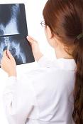 Hernia de disc