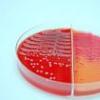 Bacteria E. coli afecteaza de regula copiii si batranii, spun specialistii