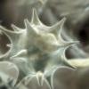 TIME avertizeaza ca Romania se afla in pragul unei epidemii de HIV