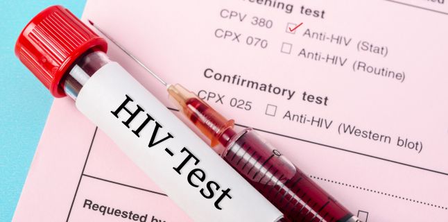 HIV, care sunt simptomele, tratamentul dar si cum previi infectarea