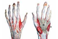 leziuni ale ligamentului la încheietura mâinii