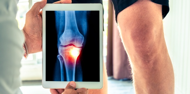 modificări degenerative în tratamentul articulației genunchiului