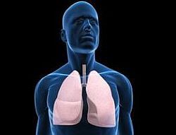Histoplasmoza pulmonara