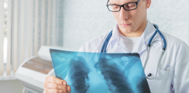 Pneumonia acută tipică pe radiografia toracică | Proceduri medicale Articulații cu pneumonie
