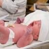 Taiere precoce a cordonului ombilical poate afecta sanatatea copilului