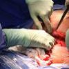 Peste 300 de transplanturi medulare au fost realizate in ultimii 10 ani la Institutul Fundeni