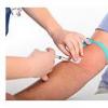Aproape 8% dintre romani, depistati cu virusul hepatitei C la testarile dintr-o campanie nationala