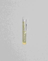Tub urina (biochimie+sediment)