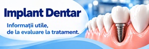 DentEstet | Implant Dentar