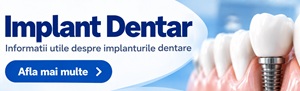 DentEstet | Implant Dentar