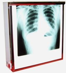 Negatoscop 40 cm x 43 cm