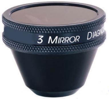 Lentila goldmann volk – sua