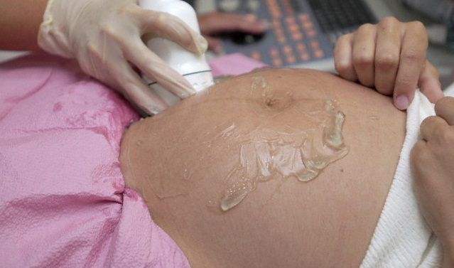 Gel Ultrasunete(Ecografie) & IPL 260 ml