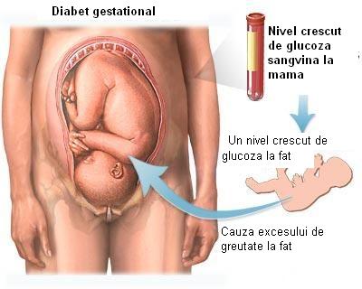 Diabet gestational