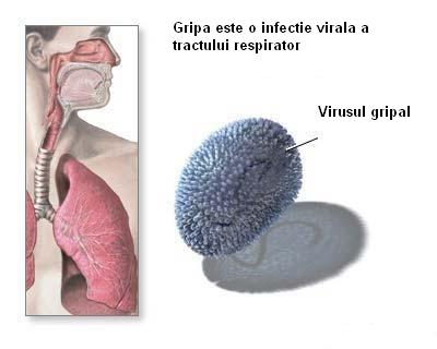 Sindroame gripale