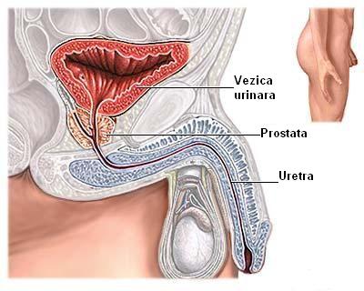 simptome de inflamație a prostatei)