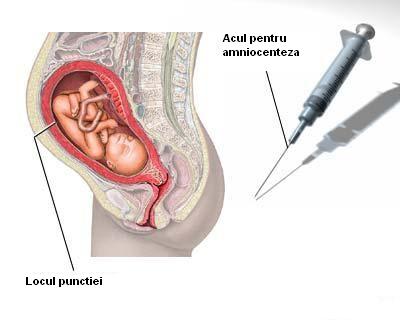 Monitorizarea prenatala a anomaliilor fetale