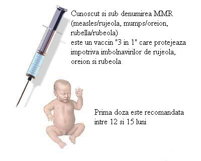Trivaccinul antirujeolic, antirubeolic, antioreionic (vaccinare neinclusa in programul national de imunizari)
