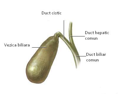 Litiaza biliara  (calculii biliari)
