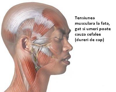 Durerile de cap (cefaleea) datorate starilor de tensiune